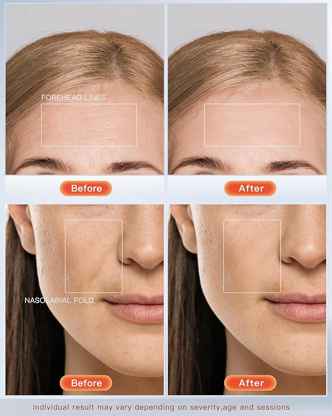 lumaderm™ Infared Red Light Face Mask